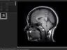 Pillanatkép 1